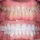 Slider image (6) Dental Project Mexico